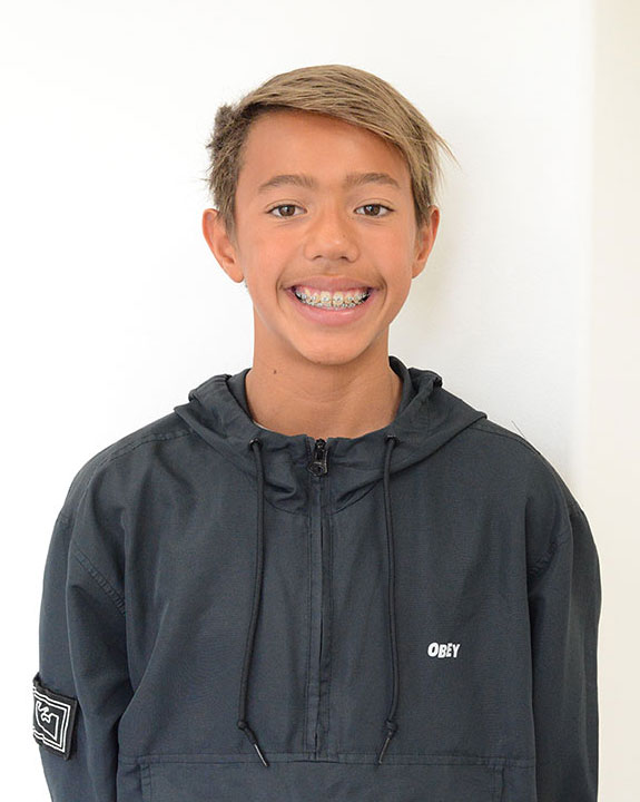 boy smiling with braces